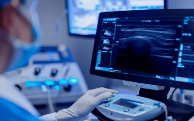 Trombosis arterial femoral tras artroplastia de cadera: la importancia de la sospecha clínica precoz