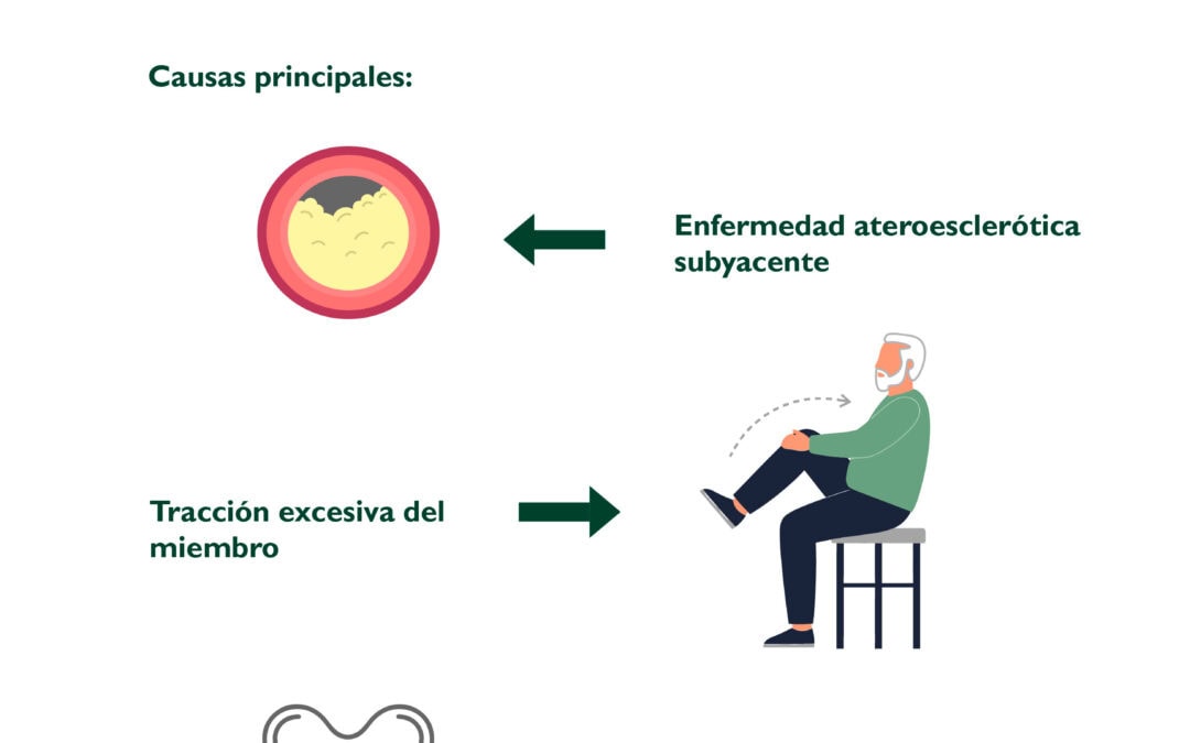 Complicaciones vasculares en la artroplastia de cadera