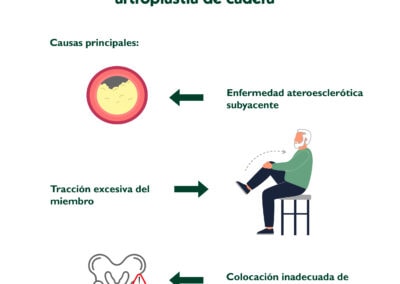 Complicaciones vasculares en la artroplastia de cadera