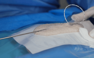 Revisión del estudio “Puncture site vs. exit site in central venous access procedures: Still a source of confusion”