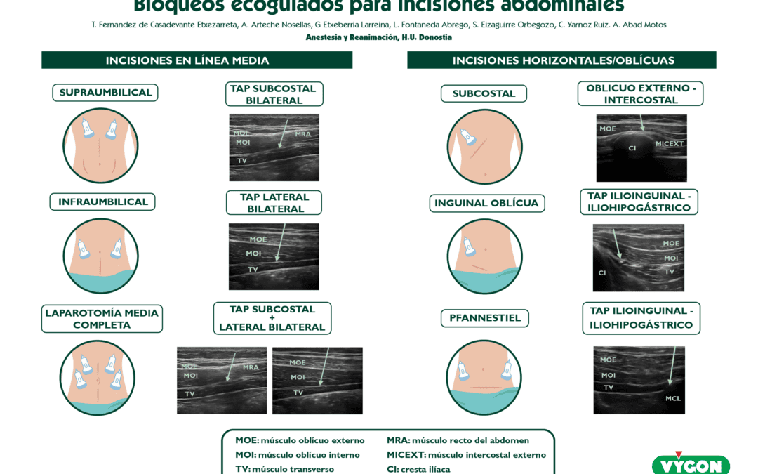 Bloqueos ecoguiados para incisiones abdominales
