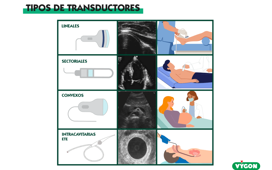 Tipos de transductores