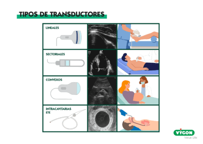 Tipos de transductores