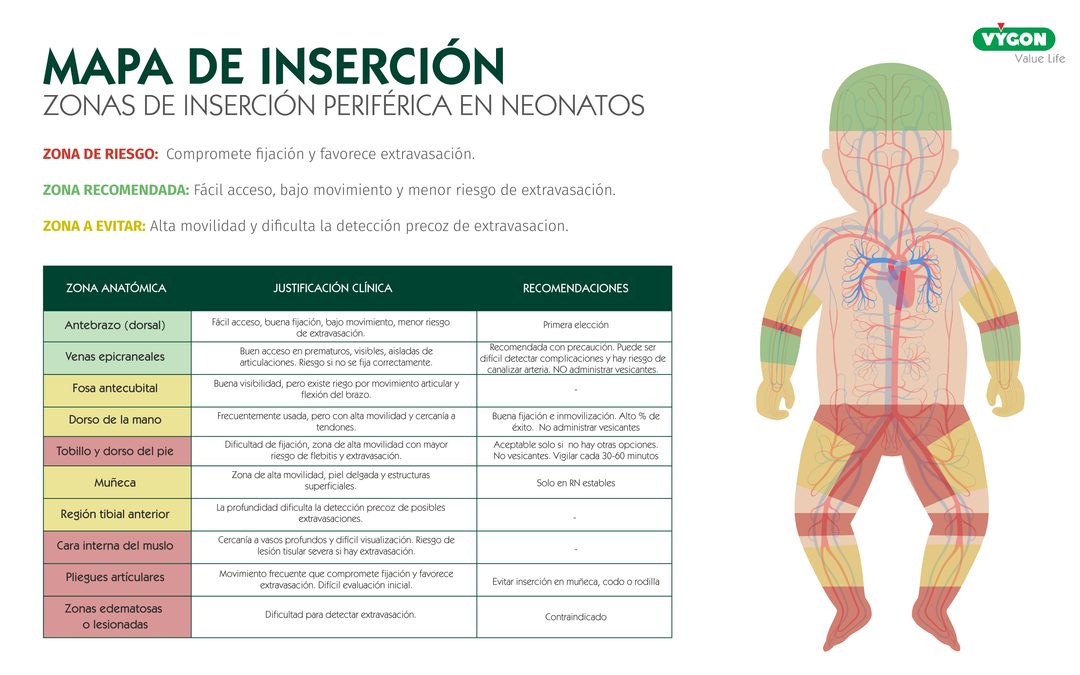 Mapa de zonas de inserción periférica en neonatos