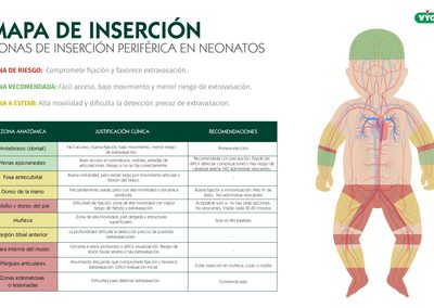Mapa de zonas de inserción periférica en neonatos