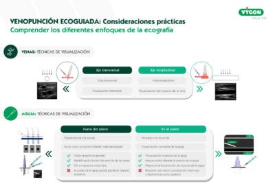 Venopunción ecoguiada: Consideraciones prácticas. Comprender los diferentes enfoques de la ecografía