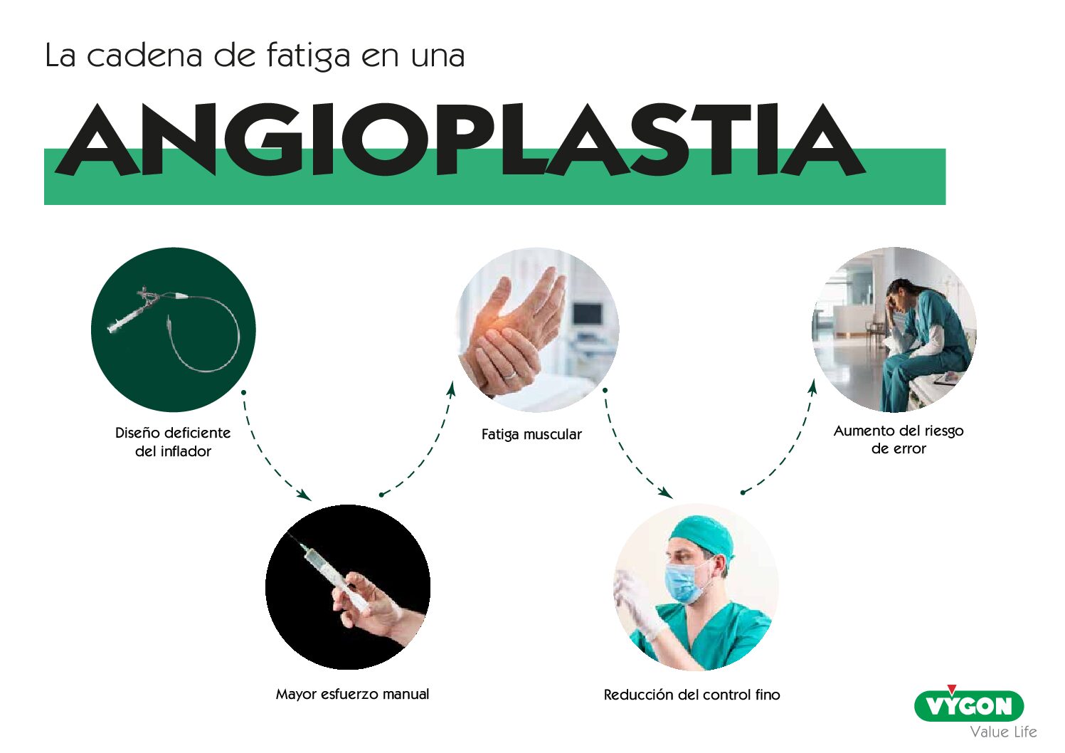 Cadena de fatiga en una angioplastia