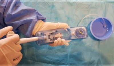 ¿Cuánto influye la ergonomía del inflador en el éxito de una angioplastia?