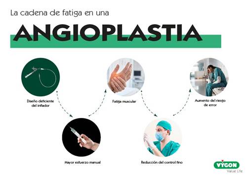 La cadena de fatiga en una angioplastia