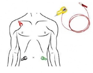 Comment localiser l'extrémité d'un PICC - ECG