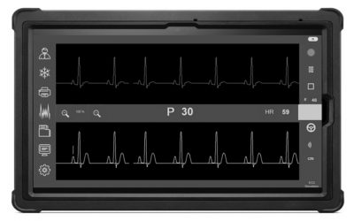 Pose de PICC chez les patients atteints de fibrillation auriculaire