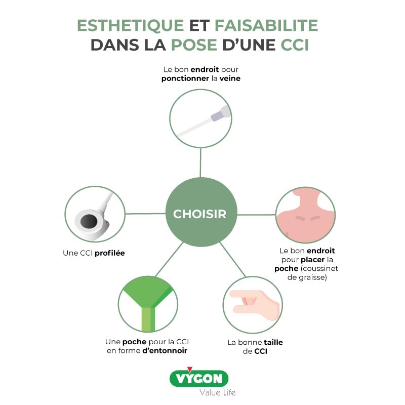 Esthétique-et-faisabilité-dans-la-pose-d-une-CCI-Choisir