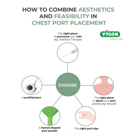 Combining aesthetics and feasibility in chest port placement - Campus ...