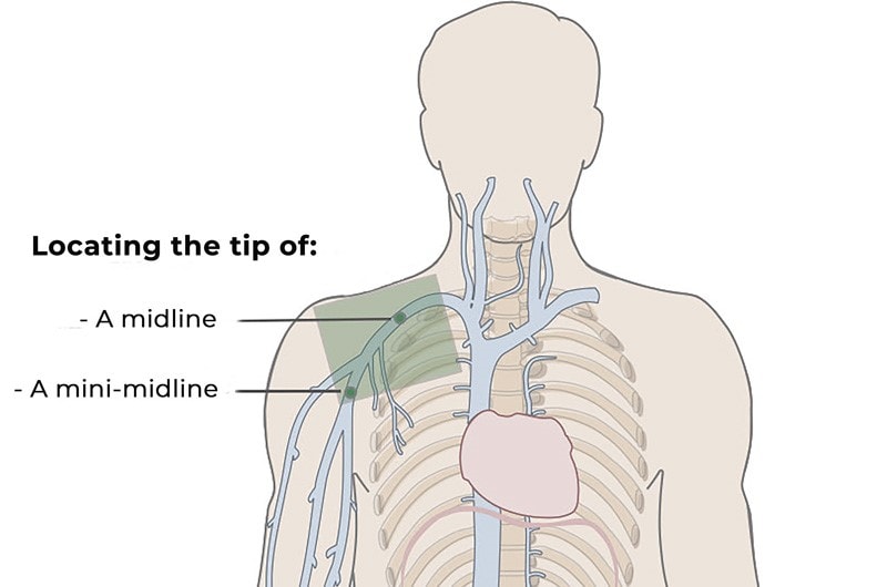 Body-with-veins-midline