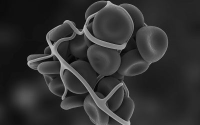 5 points essentiels sur la thrombose liée aux PICC