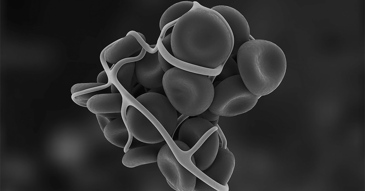 5 things to know about thrombosis in PICCs - Campus Vygon Global