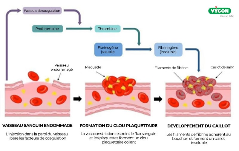 Formation-thrombus