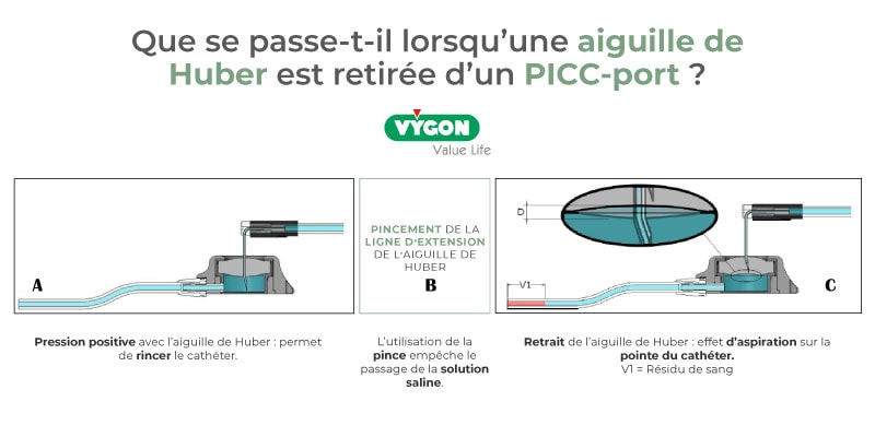 Aiguille-de-Huber-retirée-d-un-PICC-port