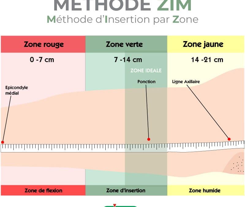 Méthode ZIM