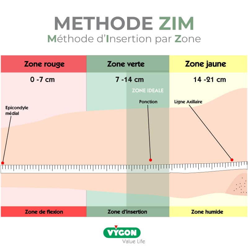 Méthode-ZIM