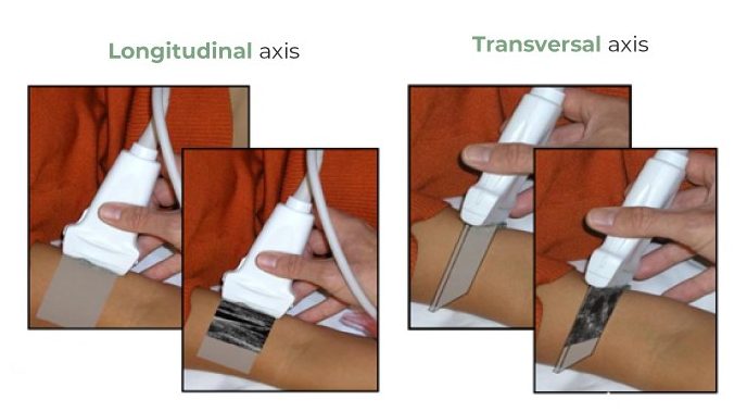 Longitudinal-vs-transversal-axis