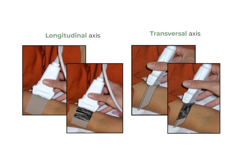 Longitudinal-vs-transversal-axis