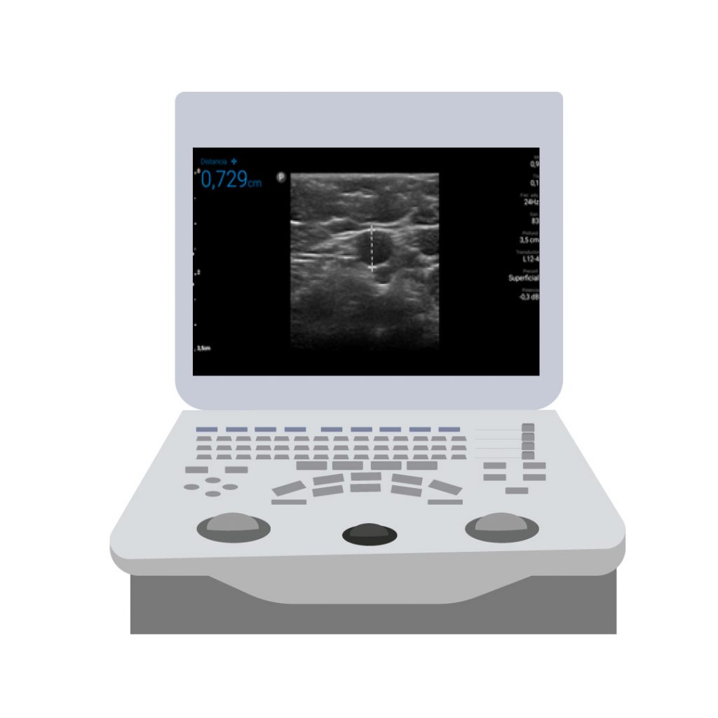 6-measures-to-ensure-the-proper-function-of-PICC-ports-Brachial-axillary-vein