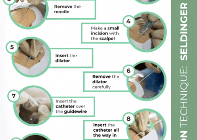 Insertion technique: Seldinger method