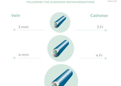 Catheter to vein ratio: choice of the right catheter diameter