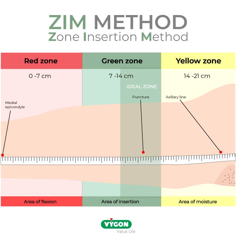 ZIM_Method