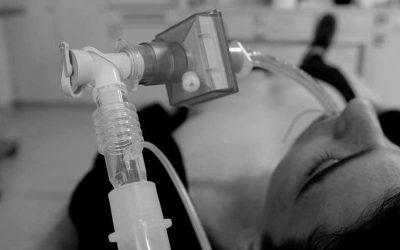 Le rôle des bougies pour garantir la sécurité de l’intubation à l’époque du Covid-19 