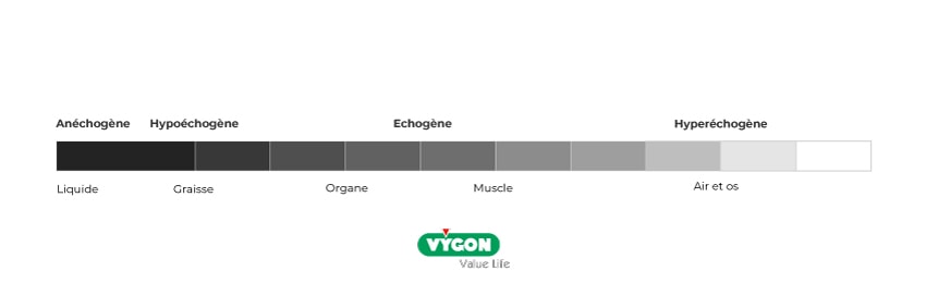 Ultrasons-Anechogene-Hypoechogene-Echogene-Hyperechogene-1