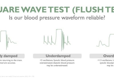 Square wave test (Flush Test)