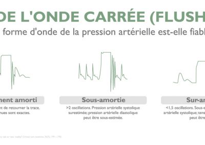 Test de l’onde carrée (Flush Test)