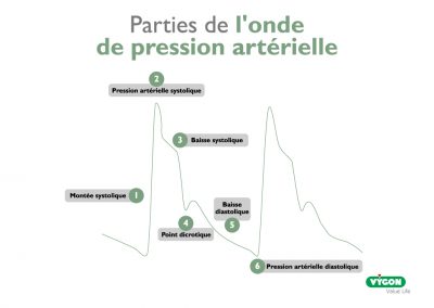 Parties de l’onde de pression artérielle