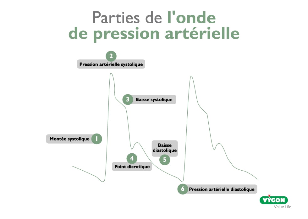 Infographie Parties de l'onde de pression artérielle