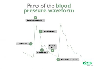 Parts of the blood pressure waveform