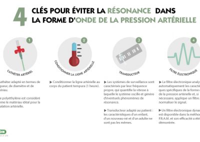 4 clés pour éviter la résonance dans la forme d’onde de la pression artérielle