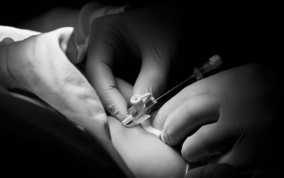 10 Clés pour une mise en place sûre du CVC dans la veine jugulaire interne en pédiatrie