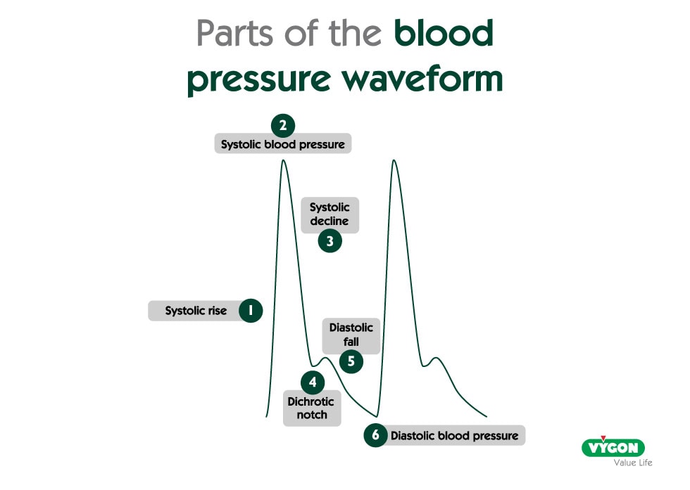 parts_waveform