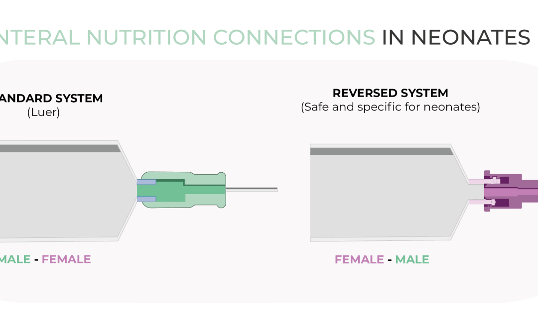 Enteral nutrition connections in neonates