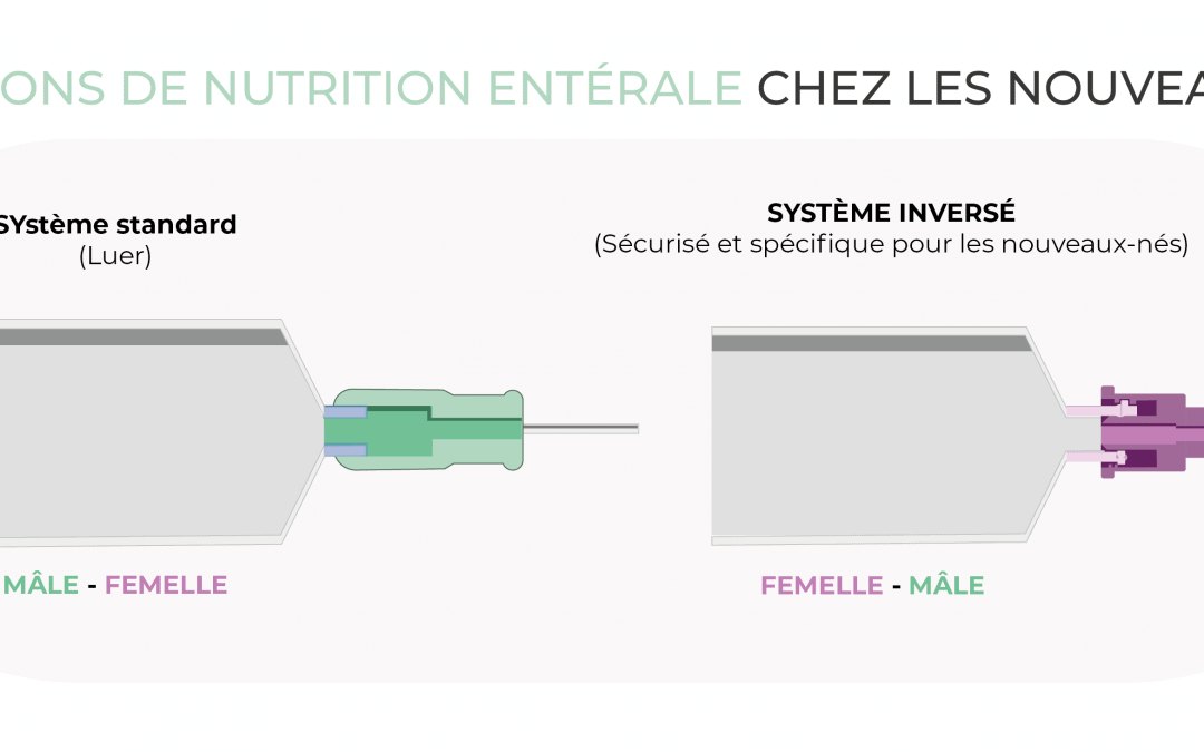 Connexions de nutrition entérale chez les nouveau-nés