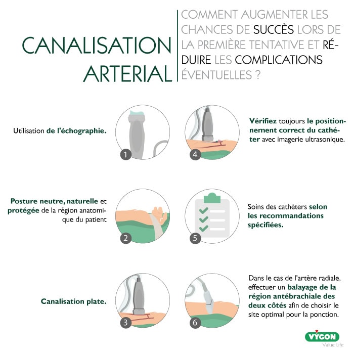 infographie médicale expliquant comment augmenter le succès de la canalisation artérielle dès la première tentative et réduire les complications : utilisation de l’échographie, positionnement optimal du patient, technique de ponction adaptée, vérification du cathéter par imagerie et respect des protocoles de soins.