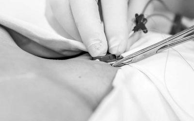 Keys to central venous line maintenance