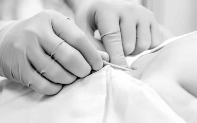 Central venous cannulation in 14 steps