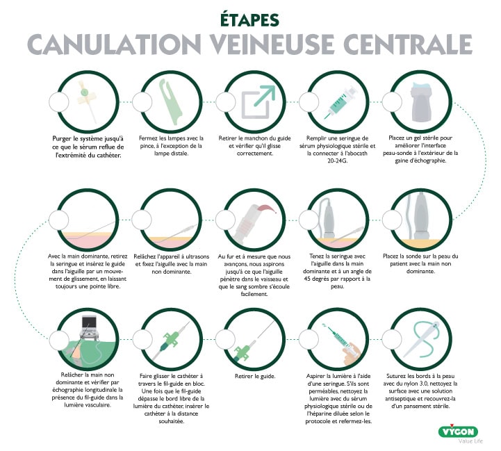 Infographie médicale détaillant les étapes de la canulation veineuse centrale sous échographie, incluant la purge du système, la préparation stérile du matériel, la ponction veineuse échoguidée, l’insertion du fil-guide, la progression du cathéter à la distance souhaitée, le contrôle de la perméabilité, le retrait du guide, la suture cutanée et la pose d’un pansement stérile, afin de sécuriser l’accès veineux central et limiter les complications.