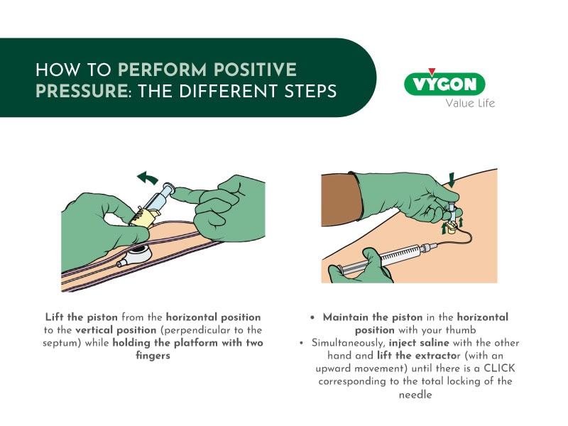 Detailed medical procedure illustration for positive pressure technique.