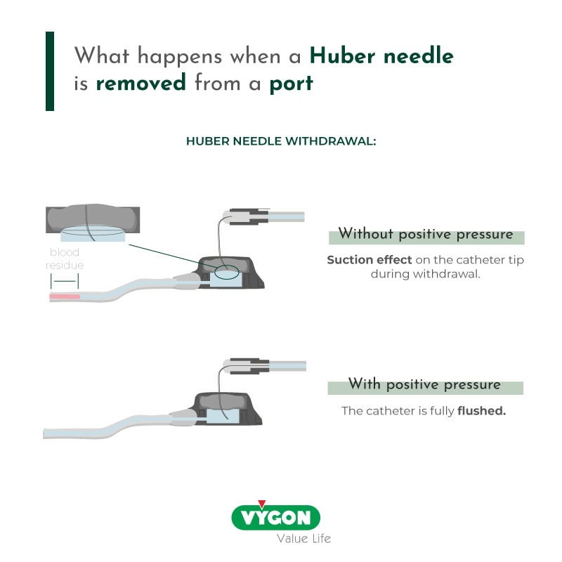 What happens when a Huber needle is removed from a port