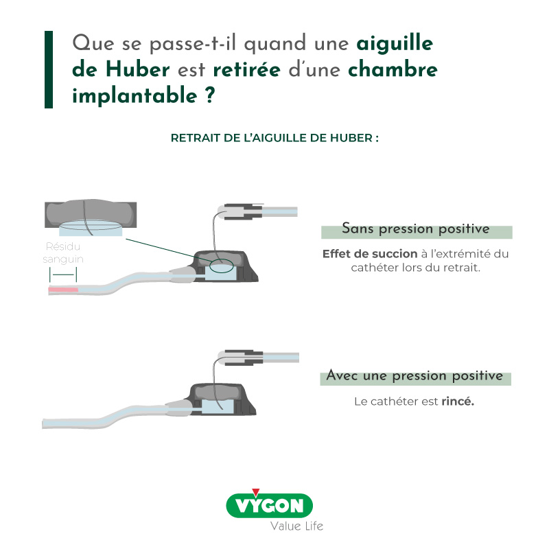 Que se passe-t-il quand une aiguille de Huber est retirée d'une chambre implantable ?