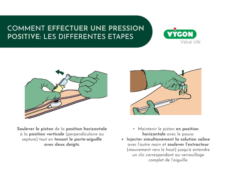 Comment_effectuer_une_pression_positive